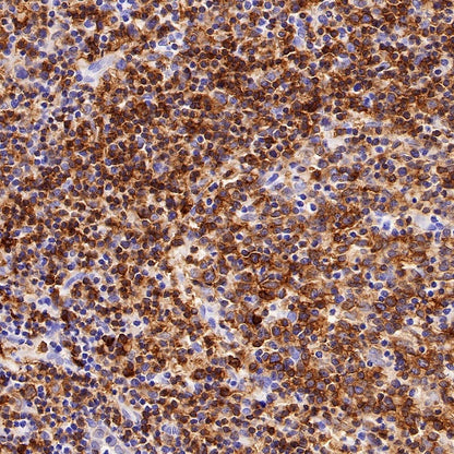 HLA-DPB1 Recombinant Rabbit mAb (S-R263)