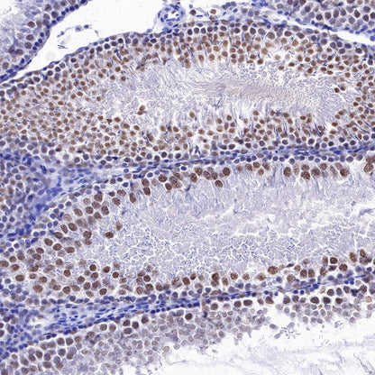 RNA polymerase II CTD repeat YSPTSPS (phosphor S2) Recombinant Rat mAb (S-R199)