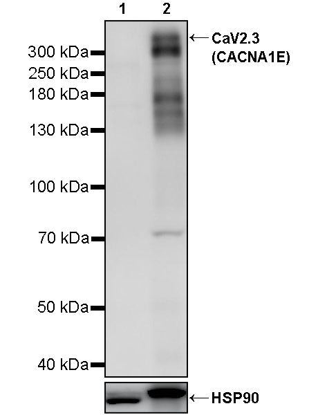 CaV2.3 (CACNA1E) Recombinant Rabbit mAb (S-3244-59)