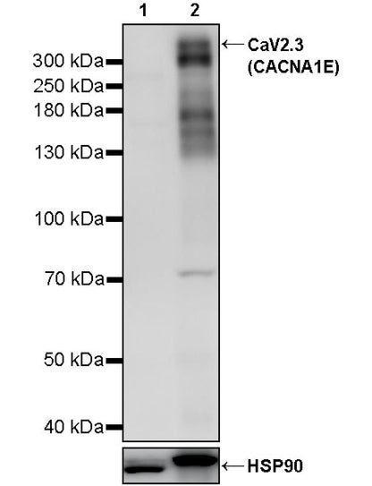 CaV2.3 (CACNA1E) Recombinant Rabbit mAb (S-3244-59)