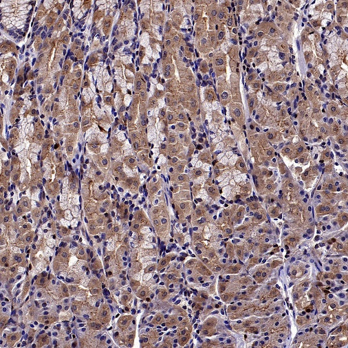 GCLM Recombinant Rabbit mAb (S-2209-19)