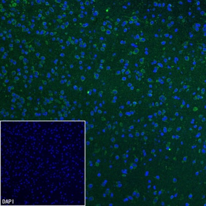 GRIA2 Rabbit Polyclonal Antibody