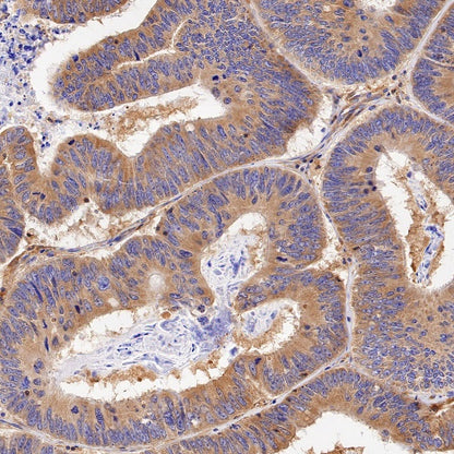 PKM2 Rabbit Polyclonal antibody