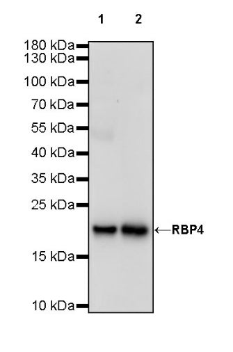RBP4 Recombinant Rabbit mAb (S-693-111)