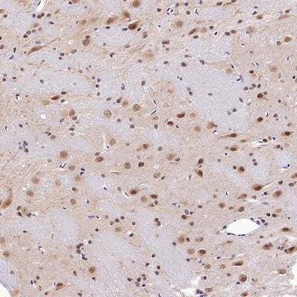 PSMB5 Rabbit Polyclonal Antibody