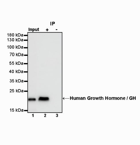 Human Growth Hormone / GH Recombinant Rabbit mAb (SDT-1160-40)