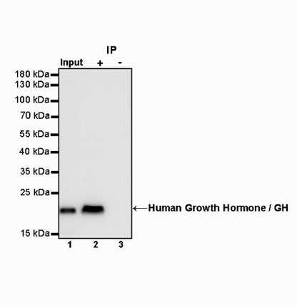 Human Growth Hormone / GH Recombinant Rabbit mAb (SDT-1160-40)