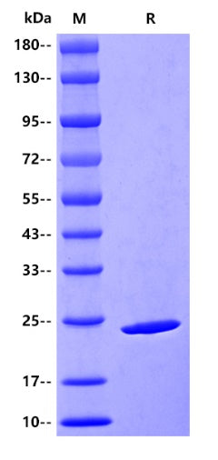 Human COL6A1/Collagen VI Protein, His tag