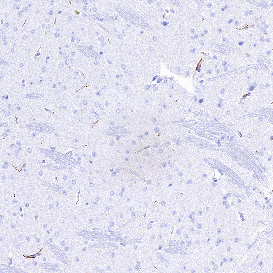 Nestin Recombinant Rabbit mAb (S-3890-61)