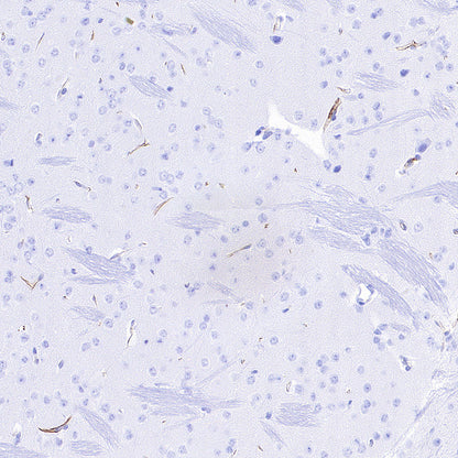 Nestin Recombinant Rabbit mAb (S-3890-61)