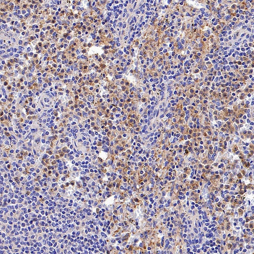 c-IAP2 Recombinant Rabbit mAb (S-3395)