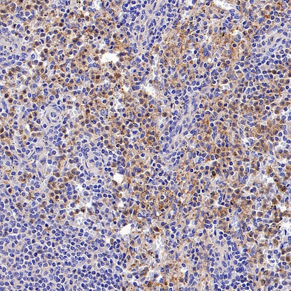 c-IAP2 Recombinant Rabbit mAb (S-3395)
