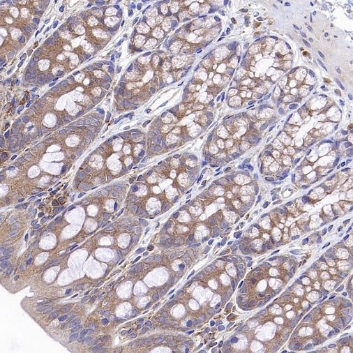 IKK gamma Recombinant Rabbit mAb (S-1359-118)