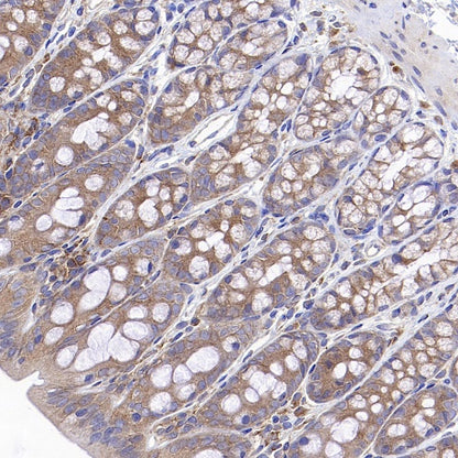 IKK gamma Recombinant Rabbit mAb (S-1359-118)