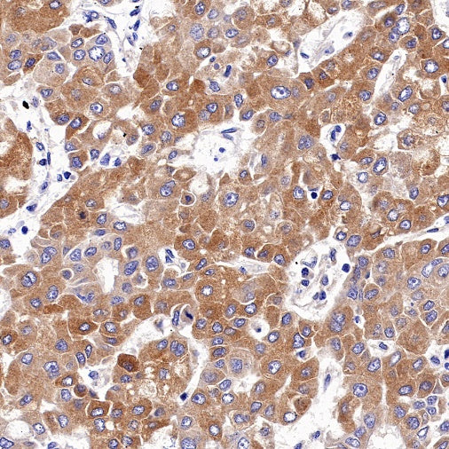 IFIT1 Recombinant Rabbit mAb (S-962-58)