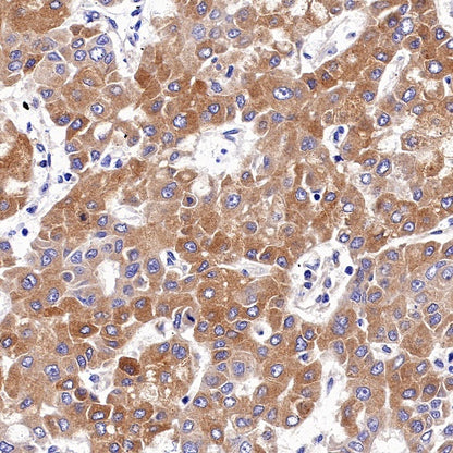 IFIT1 Recombinant Rabbit mAb (S-962-58)
