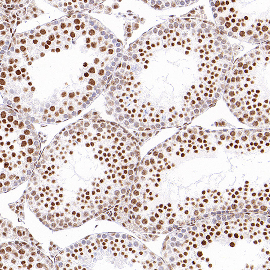 PABPN1 Rabbit Polyclonal Antibody