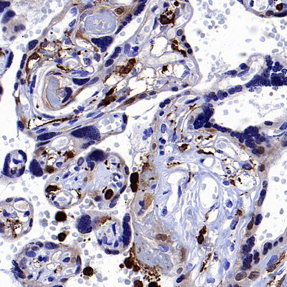 FOXO4 Recombinant Rabbit mAb (S-3527-19)