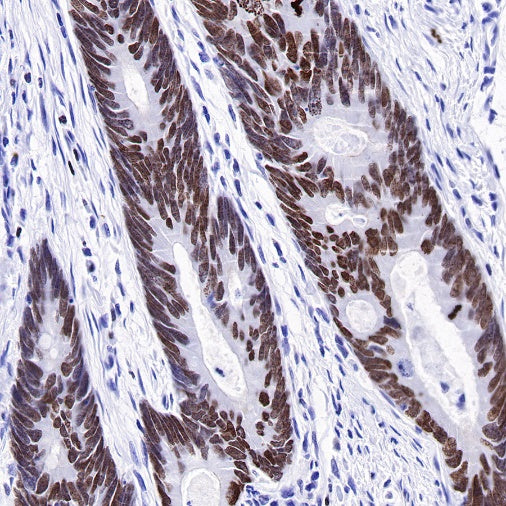 S-RMab®Topoisomerase I Recombinant Rabbit mAb (S-R209)