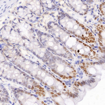c-Fos Recombinant Rabbit mAb (S-1391-63)