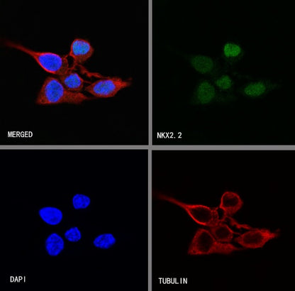 NKX2.2 Recombinant Rabbit mAb (SDT-898-41)