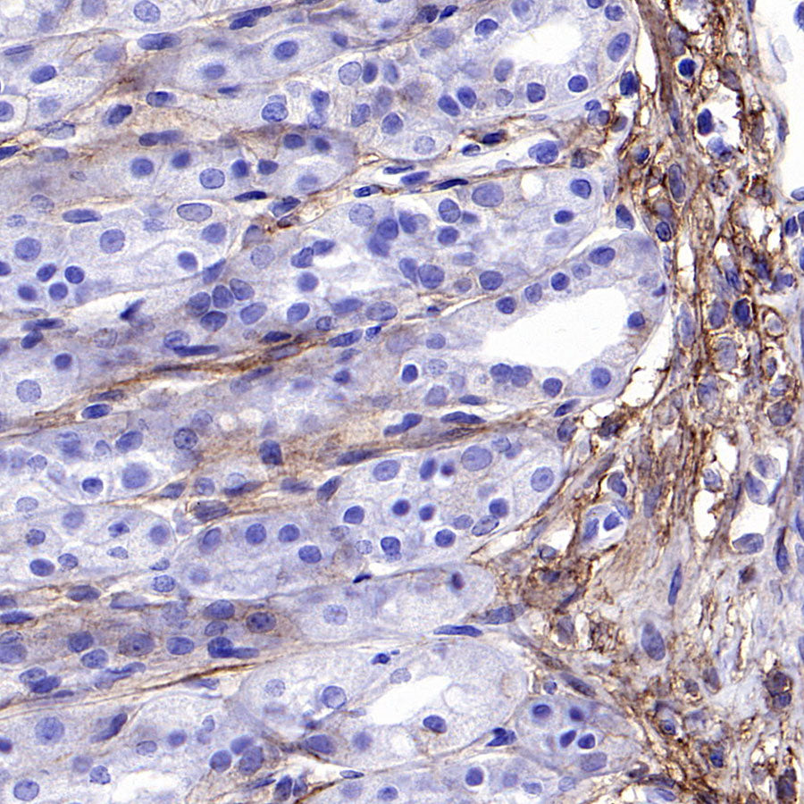 PTK7 Recombinant Rabbit mAb ,PBS Only(SDT-2432-136)