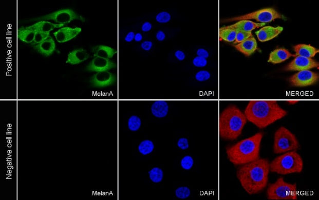MelanA Recombinant Rabbit mAb (SDT-3352)