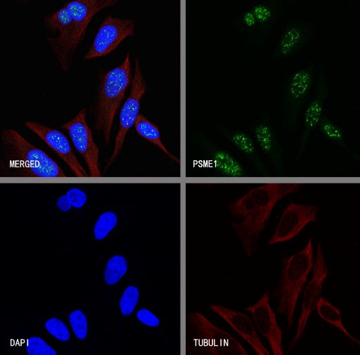 PSME1 Recombinant Rabbit mAb (S-732-14)