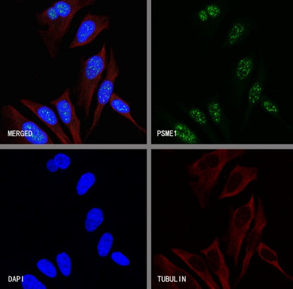 PSME1 Recombinant Rabbit mAb (S-732-14)