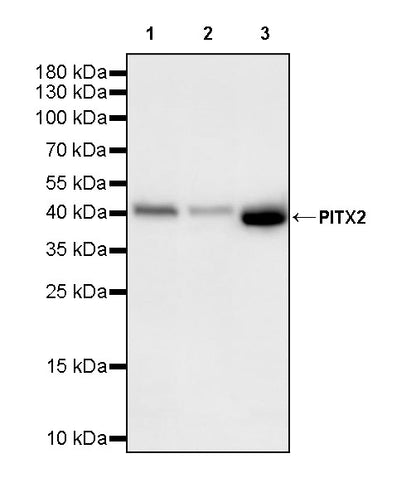 PITX2 Recombinant Rabbit mAb (S-4009-54)
