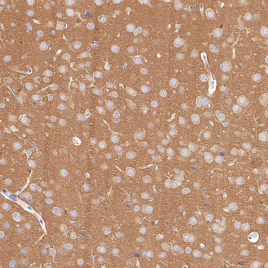 AP-2α Recombinant Rabbit mAb (S-4444-44)