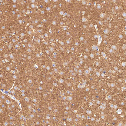 AP-2α Recombinant Rabbit mAb (S-4444-44)