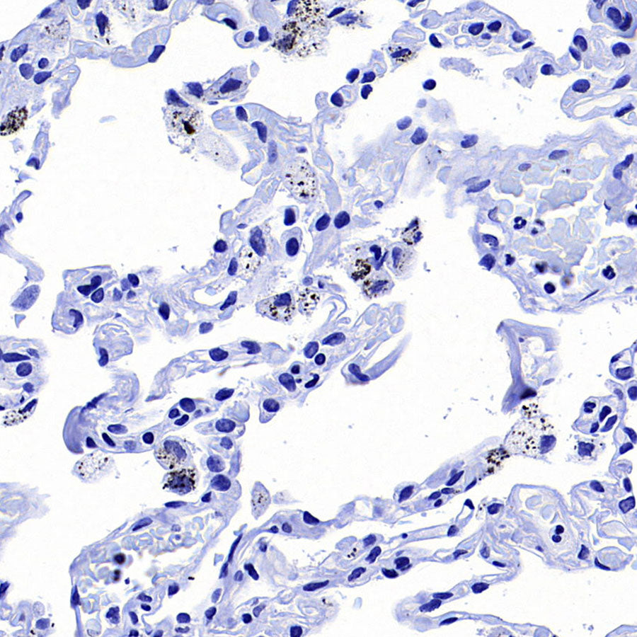 MAGE-A4 Recombinant Rabbit mAb (S-3868-66)