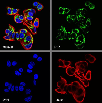 IDH2 Recombinant Rabbit mAb (S-1525-5)