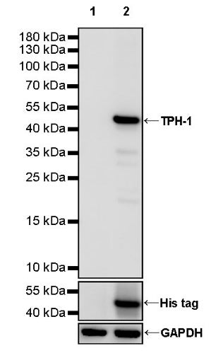 TPH-1 Recombinant Rabbit mAb (S-2287-143)