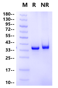 STUB1/CHIP His Tag Protein, Human