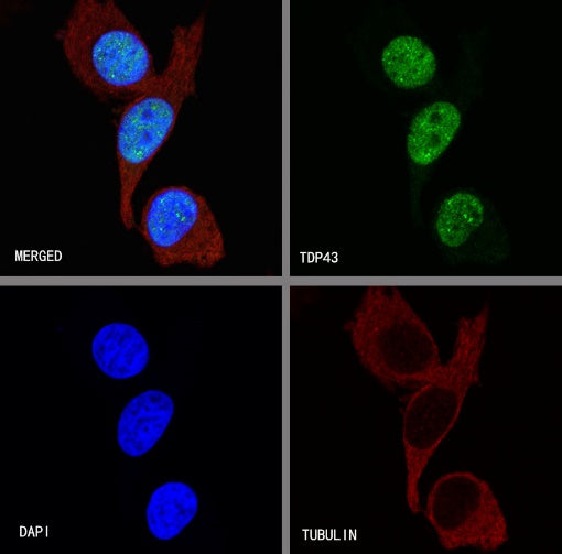 TDP43 Recombinant Rabbit mAb (S-R354)