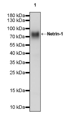Netrin-1 Recombinant Rabbit mAb (S-1510-104)