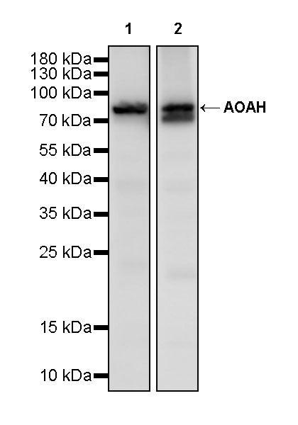 AOAH Recombinant Rabbit mAb (S-3713-10)