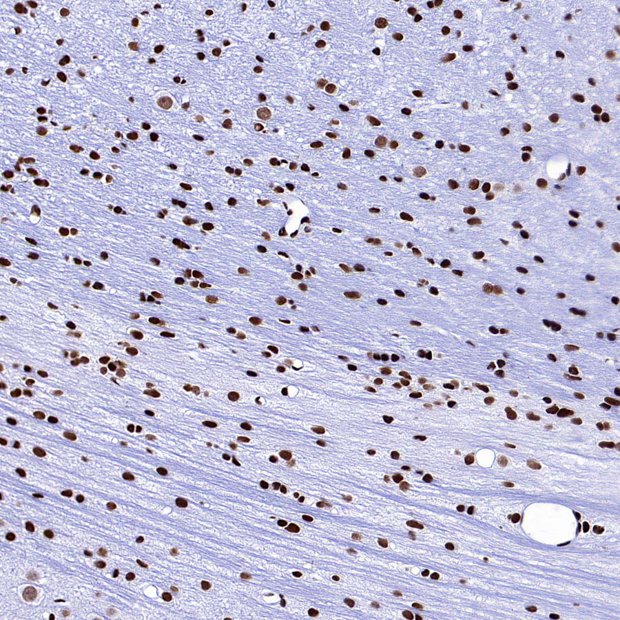 SMC1 Recombinant Rabbit mAb (S-4147-54)