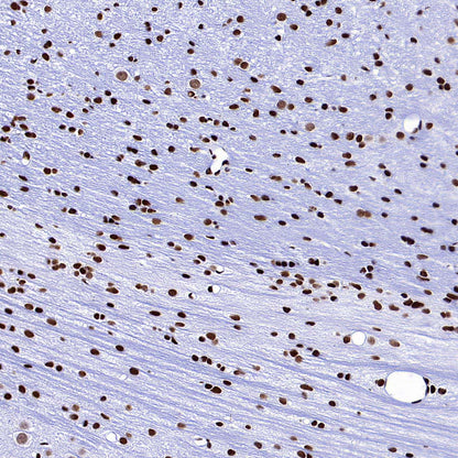 SMC1 Recombinant Rabbit mAb (S-4147-54)