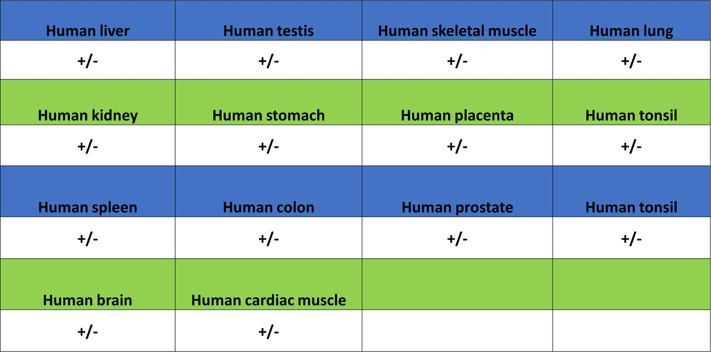 TRIM21 Mouse mAb (S-M0045)
