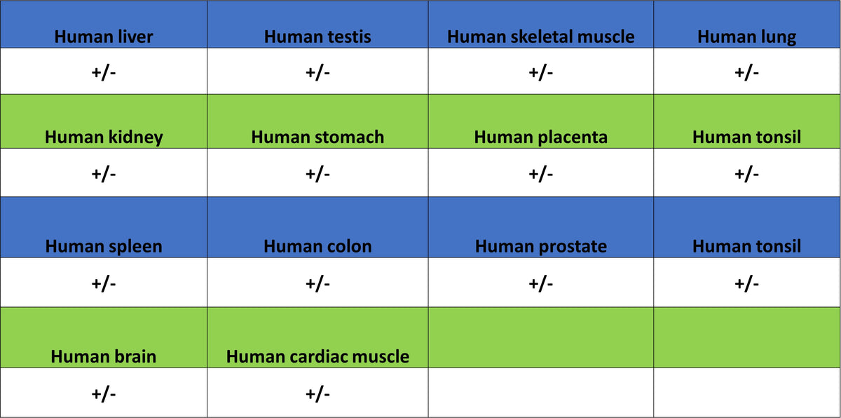 TRIM21 Mouse mAb (S-M0045)