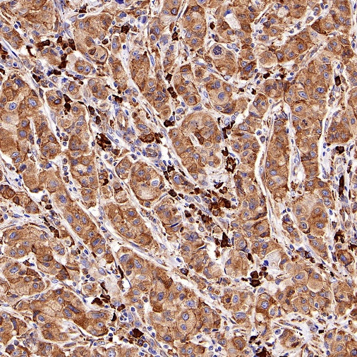 GRP94 Recombinant Rabbit mAb (S-R268)