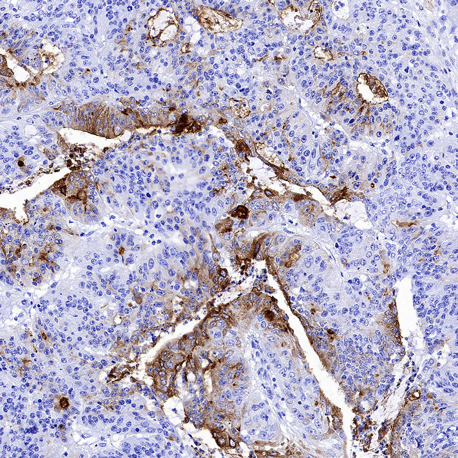MUC17 Recombinant Rabbit mAb (SDT-3951-108)