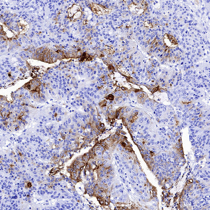 MUC17 Recombinant Rabbit mAb (SDT-3951-108)