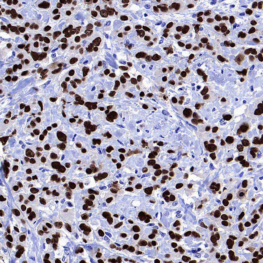 FOXA1 Recombinant Rabbit mAb (S-4339)