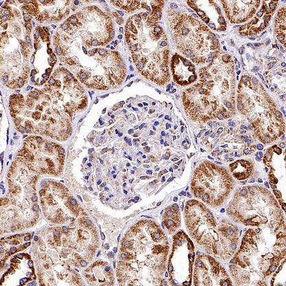 Rheb Rabbit Polyclonal Antibody
