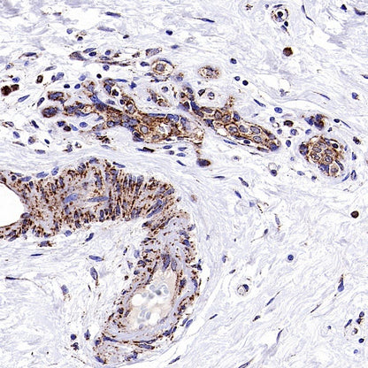Fumarate hydratase Recombinant Rabbit mAb, PBS Only (SDT-2394-36)