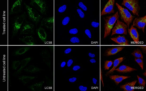LC3B Recombinant Rabbit mAb (S-1599-142)